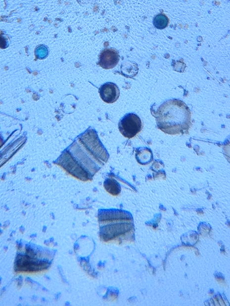 DIY: Το Μικροσκόπιο των $10
